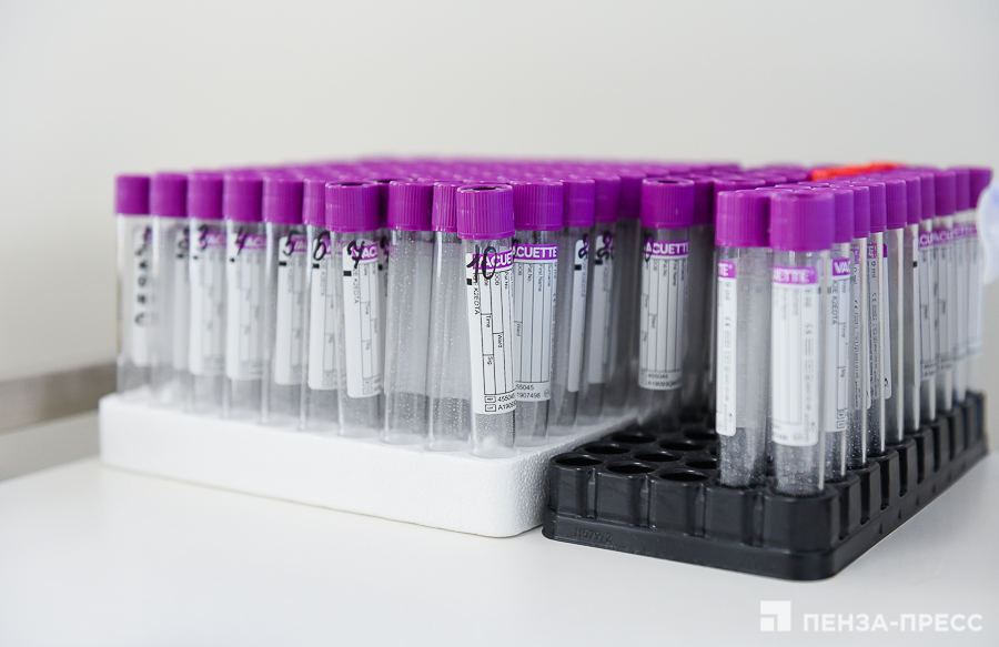 
		
		Пензенцам перед донацией будут делать тест на антитела к Covid-19
		
	