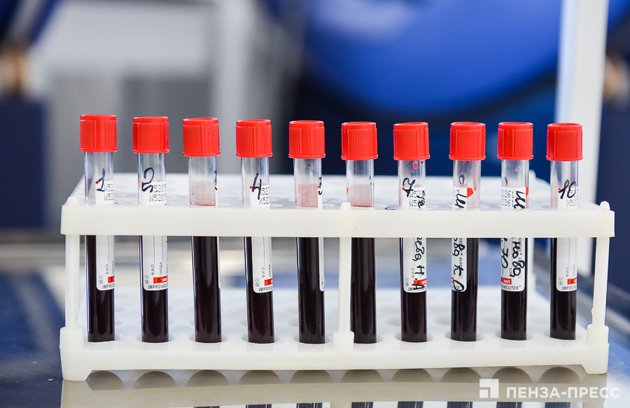 
		
		В Пензе благодаря акции волонтеров-медиков заготовили 30 литров донорской крови
		
	